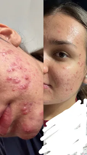 Dr. Ștefan Pop - Dermatologie. Estetica. Laserterapie
