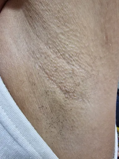 SKIN ART By Natalia Tudoran