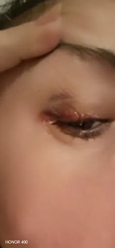 Hyperclinica MedLife Braila