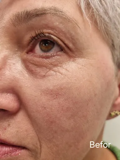 DERMAKRON LASER CLINIC