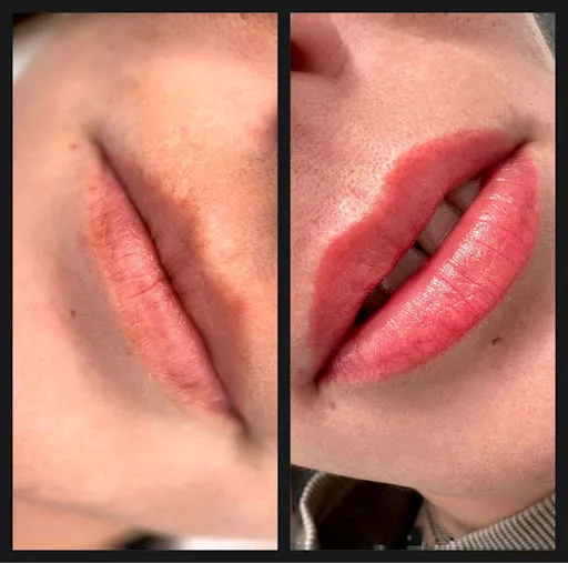 G Beauty Center|Centru de estetica faciala si corporala