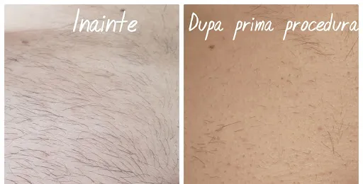 Simeral Beauty Center