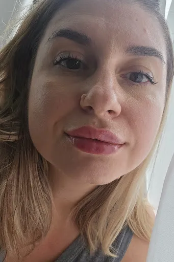 Top Skin – Clinica de Dermatologie si Estetica Medicala | Dr. Roxana Chelaru